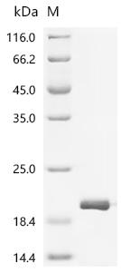 SDS-PAGE