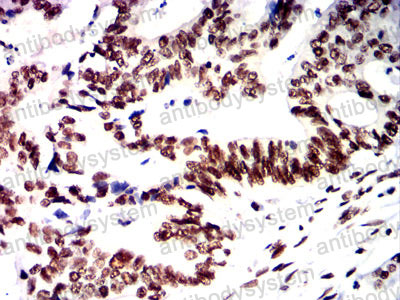 Валидация AntibodySystem RHF03006