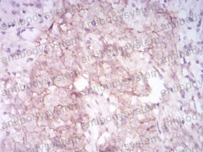 Валидация AntibodySystem RHE75503