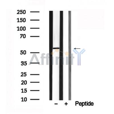 Валидация Affinity AF7644 - 4320