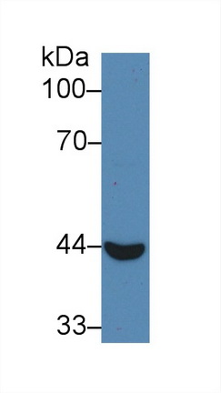 55574