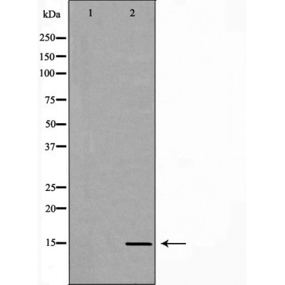 Валидация Affinity DF7140 - 18790
