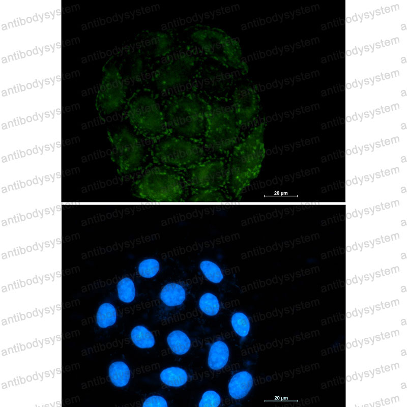 Валидация IF - AntibodySystem RHC21903
