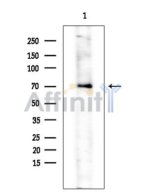 Валидация Affinity AF3466 - 1981
