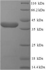 SDS-PAGE