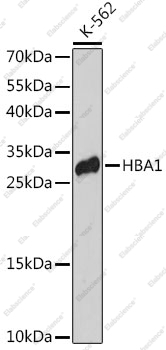 Вестерн-блоттинг, HBA1, клетки K-562