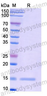 Валидация SDS-PAGE - AntibodySystem RHF68301