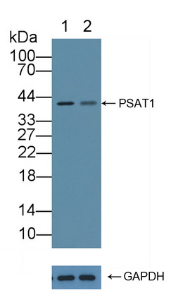 12295
