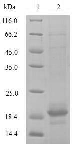 SDS-PAGE