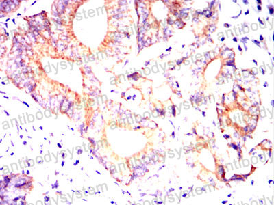 Валидация AntibodySystem RHN06803 (3794)