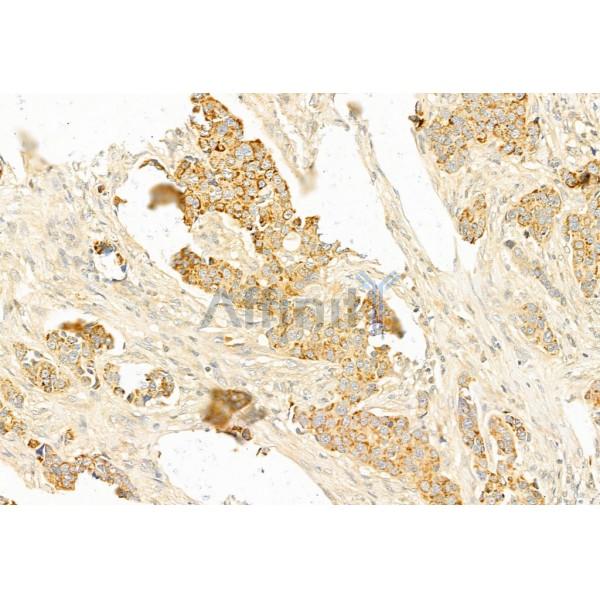 Валидация Affinity AF6385 - 3682