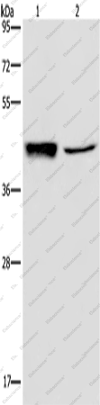 Вестерн-блоттинг, GRPR, ткань гепатоцеллюлярной карциномы человека и клетки A549