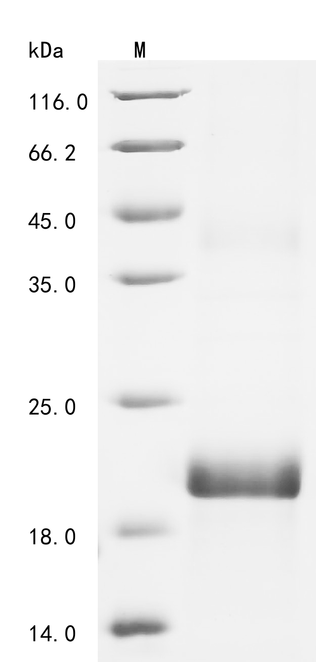 SDS-PAGE
