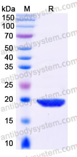 YHC00902, SDS-PAGE