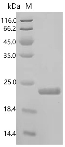 SDS-PAGE