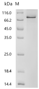 SDS-PAGE