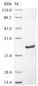 SDS-PAGE