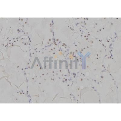 Валидация Affinity DF6937 - 18549