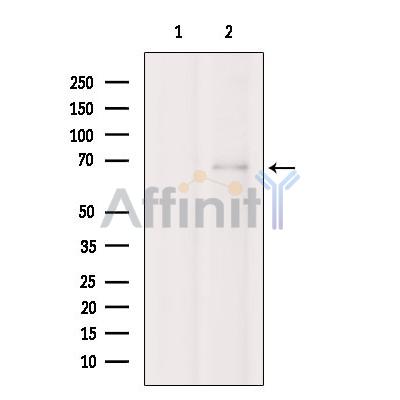 Валидация Affinity DF6094 - 17311