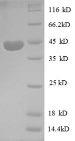 SDS-PAGE