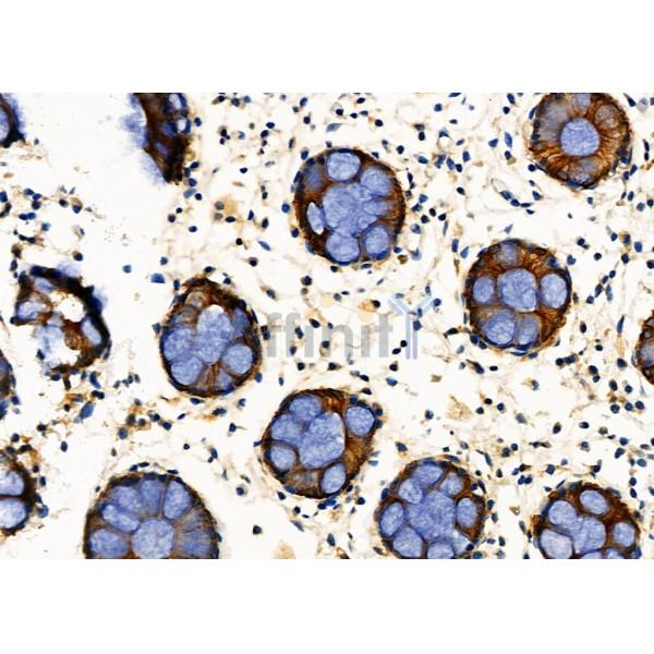 Валидация Affinity DF6265 - 17559