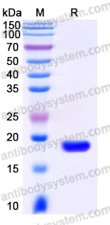 EHC05601, SDS-PAGE
