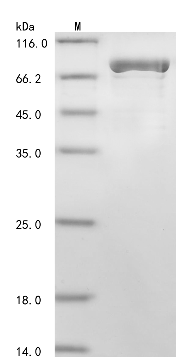 SDS-PAGE