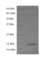 SDS-PAGE
