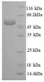 SDS-PAGE