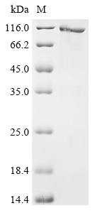 SDS-PAGE