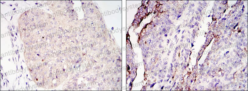 Валидация AntibodySystem RHH86802
