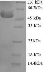 SDS-PAGE