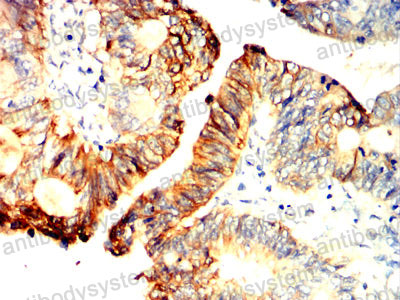Валидация AntibodySystem RHG01803