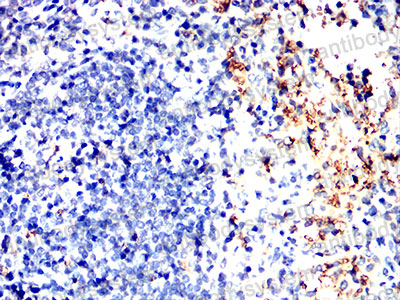 Валидация AntibodySystem RHB67102