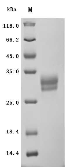SDS-PAGE