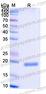 AHJ41201, SDS-PAGE