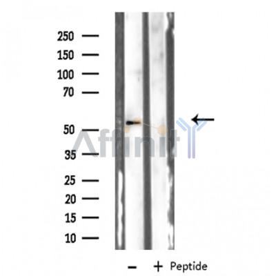 Валидация Affinity DF3511 - 14436