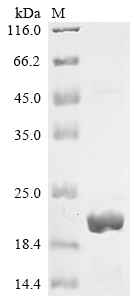 SDS-PAGE