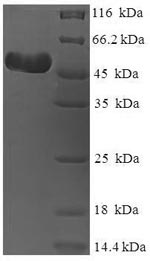SDS-PAGE