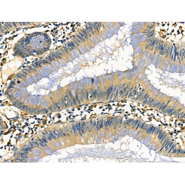 Валидация Affinity DF6457 - 17842