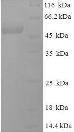 SDS-PAGE
