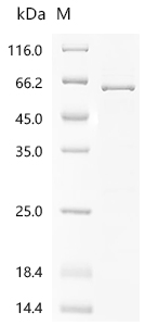 SDS-PAGE