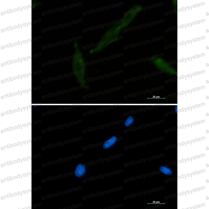 Валидация IF - AntibodySystem RME14001