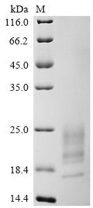 SDS-PAGE
