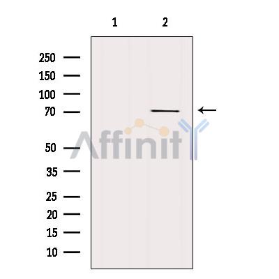 Валидация Affinity AF6416 - 3715