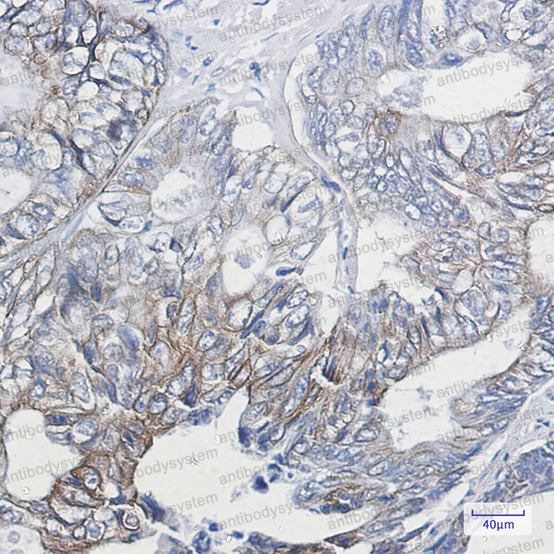 Валидация AntibodySystem RHC17903