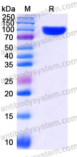 EHH39203, SDS-PAGE