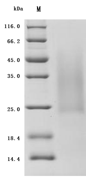 SDS-PAGE