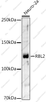 Вестерн-блоттинг, RBL2, клетки Neuro-2a