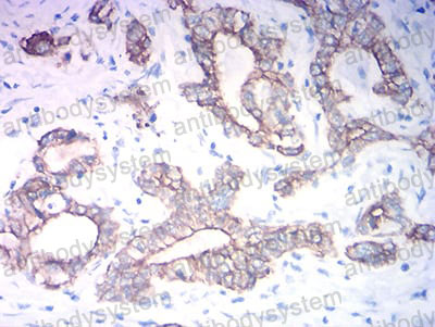 Валидация AntibodySystem RHC36008